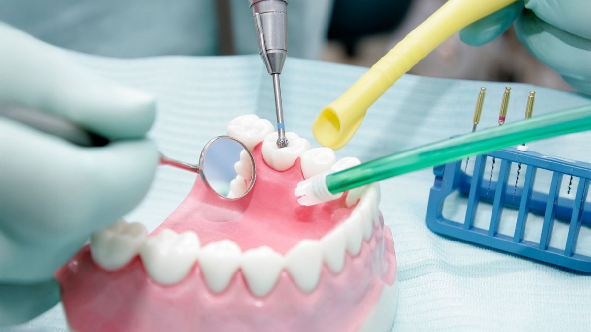 Can Dental Assistants Perform Fillings